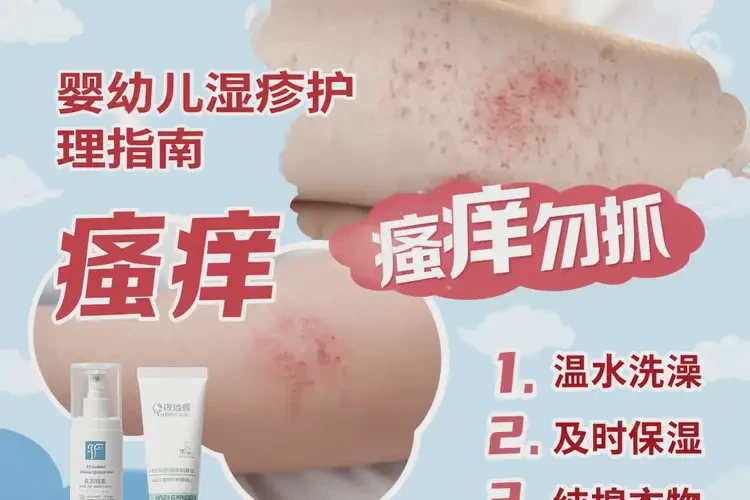 婴幼儿四肢容易起湿疹不管它会自己好吗(图4)