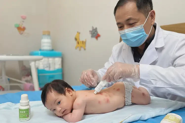 寶寶屁股偶爾長濕疹能夠徹底治愈嗎(圖3)