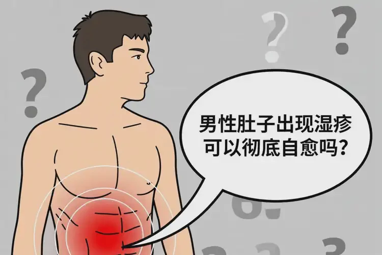 男性肚子出現濕疹可不可以徹底自愈(圖4)