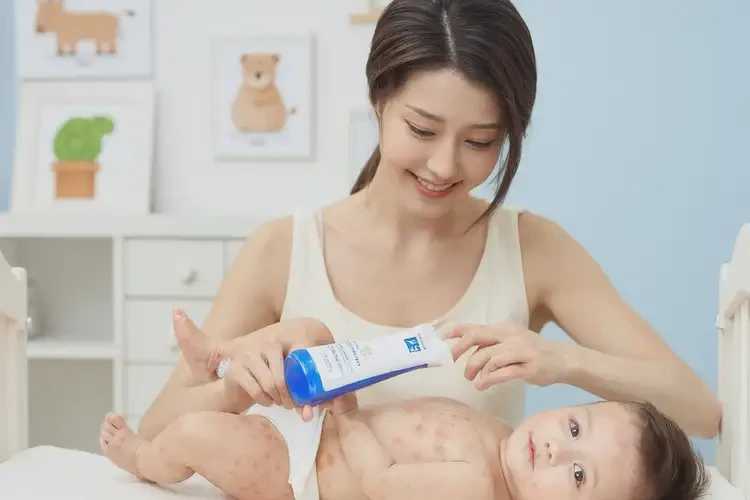 宝宝身上出湿疹不管它会自己自愈吗(图3)