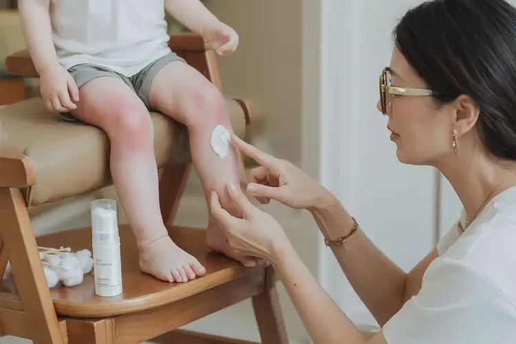 孩子腳上起濕疹不管它會自己好嗎(圖2)