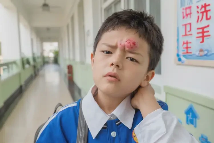 小學(xué)生脖子有濕疹不管它會(huì)自己痊愈嗎(圖4)