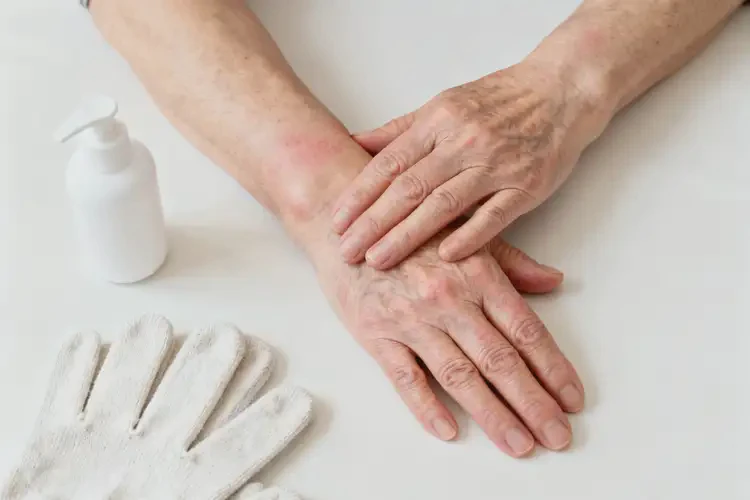 老年人手上偶爾長濕疹可不可以徹底自愈(圖2)