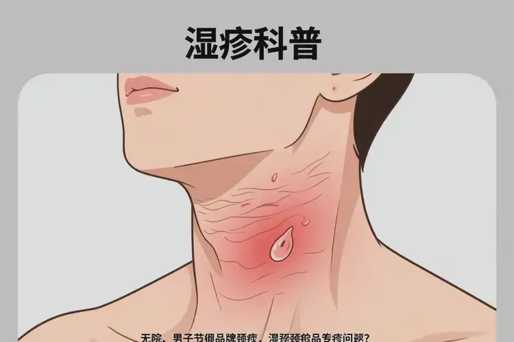 男人脖子上有濕疹能夠徹底治愈嗎(圖2)