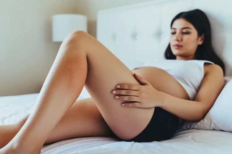 孕婦四肢有濕疹不管它會(huì)自己痊愈嗎(圖3)