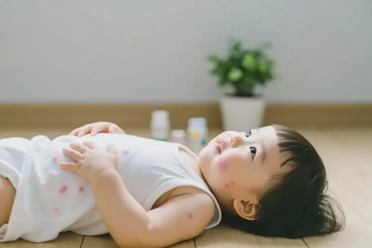 幼兒肚子上偶爾長(zhǎng)濕疹能靠自己自愈嗎(圖2)