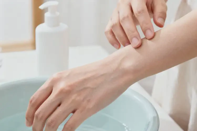 哺乳期媽媽手上偶爾起濕疹可不可以徹底自愈(圖3)