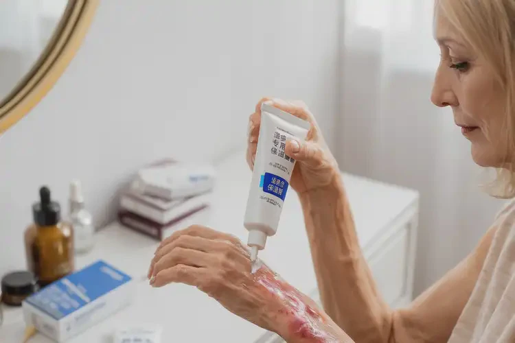 男生身上偶爾起濕疹不管它會自己痊愈嗎(圖2)