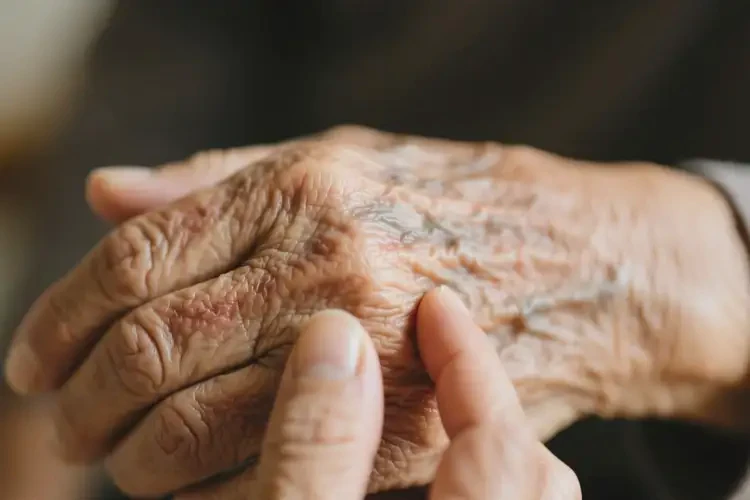 老人手臂長濕疹能徹底自愈嗎(圖3)