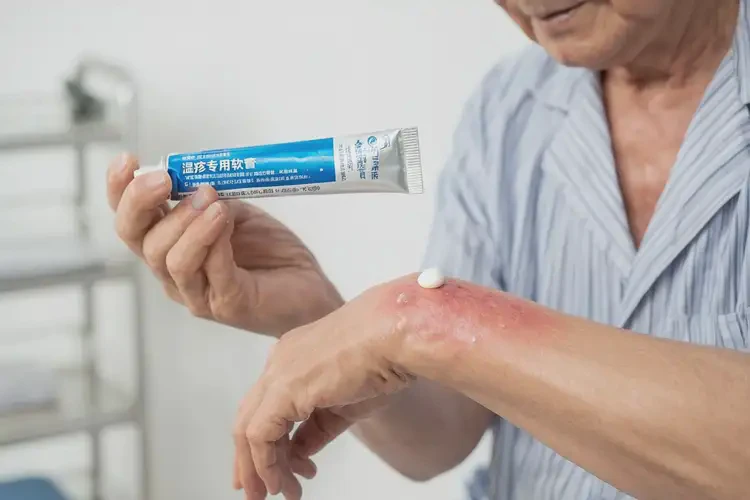 中学生身上容易起湿疹能够彻底治愈吗(图4)