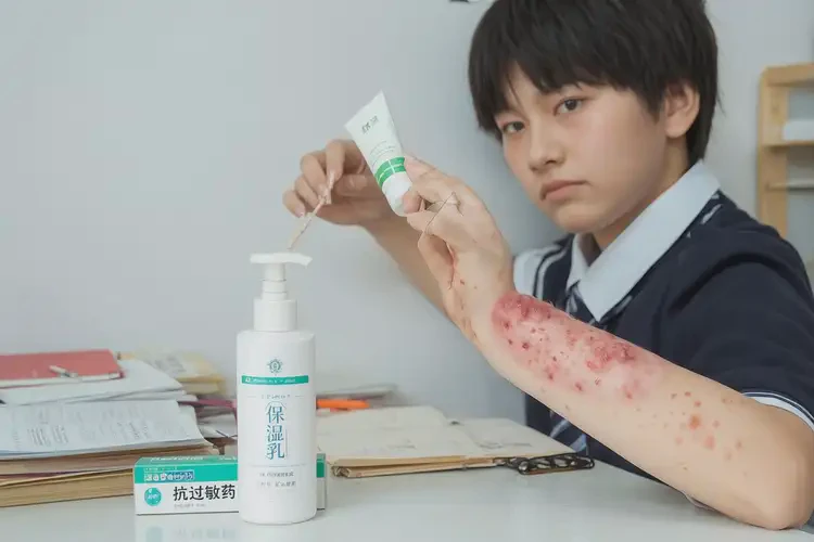 中學(xué)生手臂上偶爾長(zhǎng)濕疹能夠徹底治愈嗎(圖4)