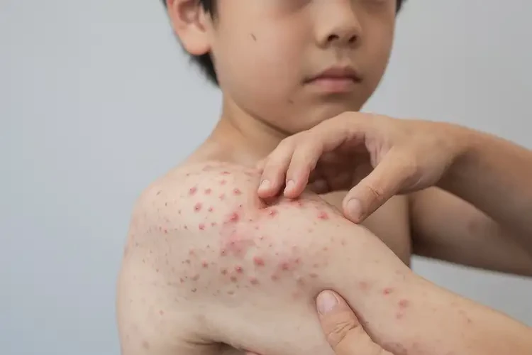 青少年手臂上容易長(zhǎng)濕疹可以徹底自愈嗎(圖4)