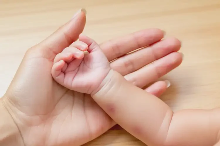 新生兒手臂經(jīng)常起濕疹不管它會(huì)自己自愈嗎(圖1)