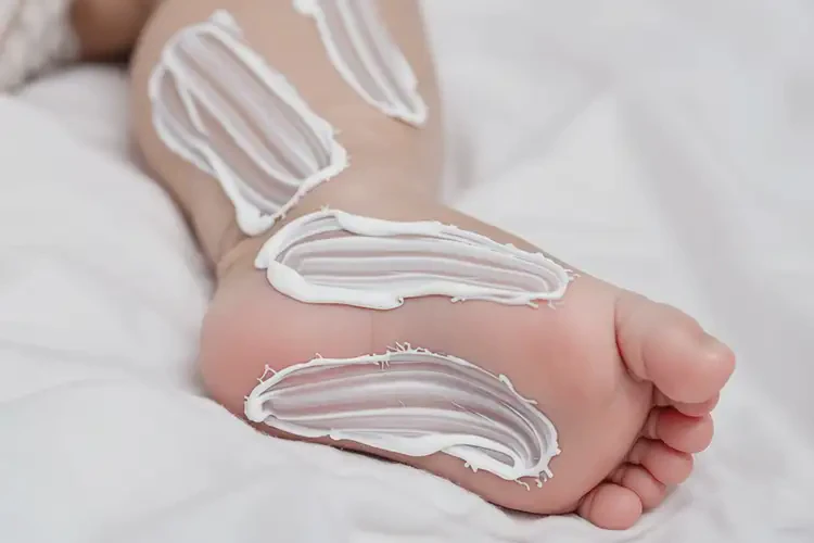 嬰兒小腿上經(jīng)常長(zhǎng)濕疹能夠徹底治愈嗎(圖2)