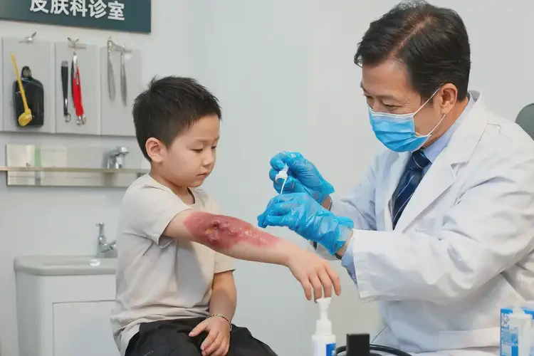 少儿手臂经常长湿疹可以彻底自愈吗(图3)