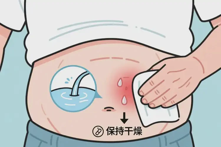 老年人肚子出濕疹能夠徹底治愈嗎(圖2)