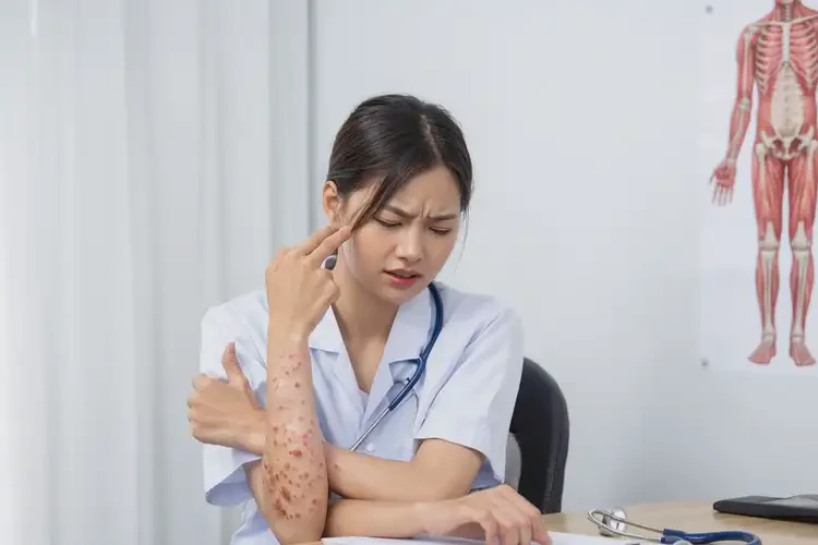 女生身上出濕疹可不可以徹底自愈(圖4)