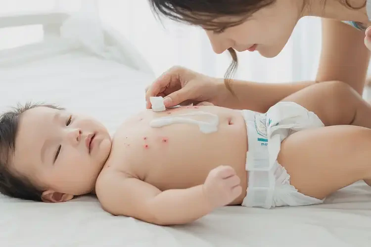婴儿肚子容易长湿疹不管它会自己自愈吗(图3)