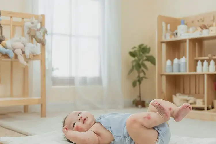 幼兒四肢出濕疹不管它會(huì)自己自愈嗎(圖1)