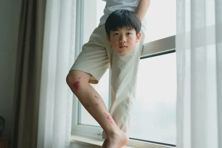 中學生小腿上起濕疹不管它會自己痊愈嗎(圖2)