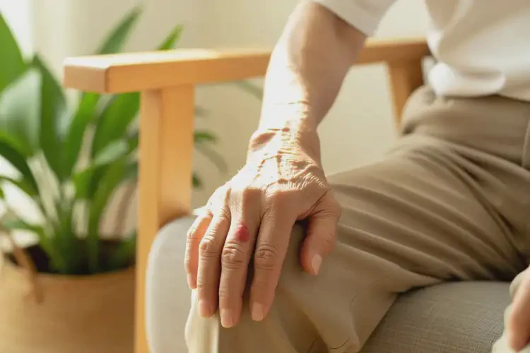 高齡老人手臂上偶爾起濕疹可以徹底自愈嗎(圖4)