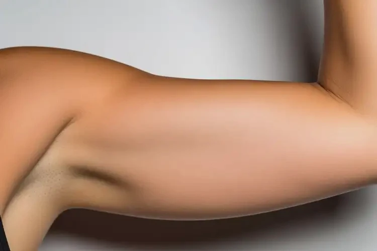 孕婦手臂出現(xiàn)濕疹可以徹底自愈嗎(圖1)