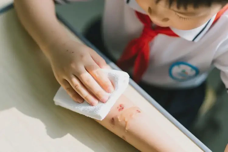 小學(xué)生手臂長(zhǎng)濕疹能不能徹底自愈(圖2)