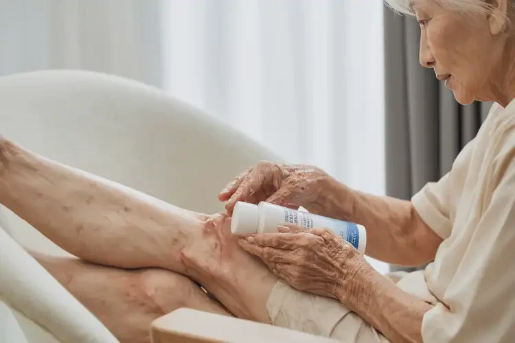 高齡老人小腿偶爾長(zhǎng)濕疹能徹底自愈嗎(圖3)