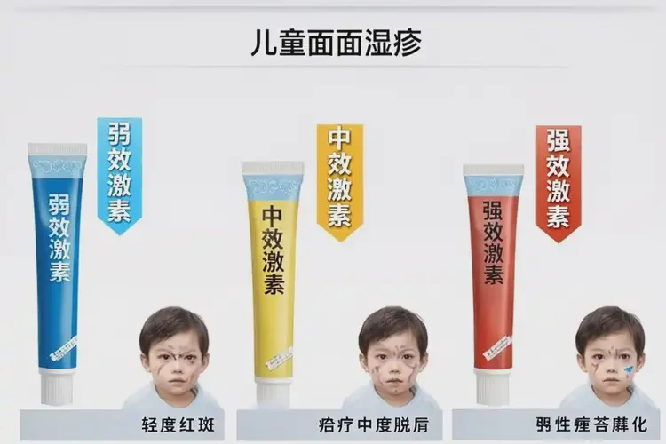 小孩臉上容易長濕疹能夠徹底治愈嗎(圖4)