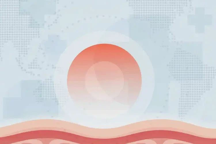 女性肛周有濕疹不管它會自己自愈嗎(圖3)