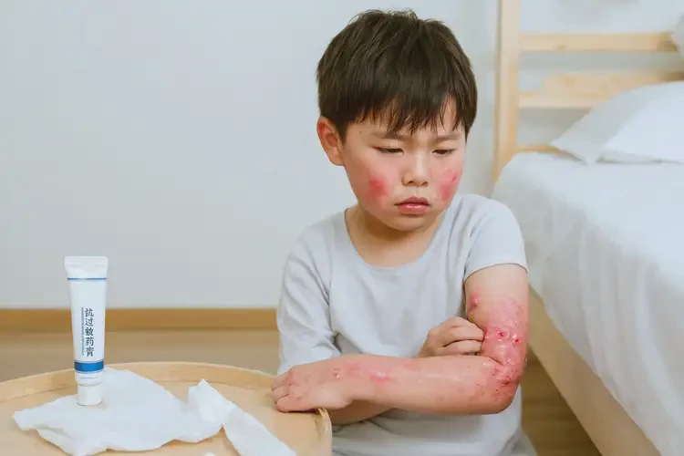 儿童全身容易长湿疹可以彻底自愈吗(图3)