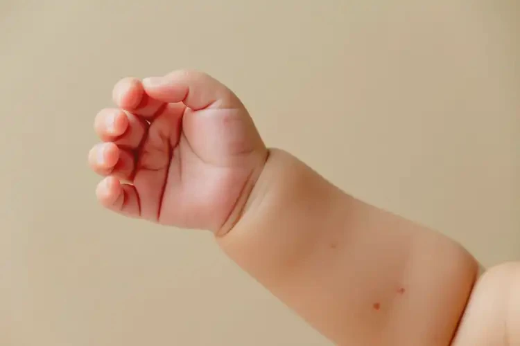嬰兒手臂偶爾長(zhǎng)濕疹能夠徹底治愈嗎(圖4)