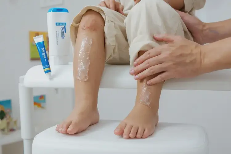 儿童小腿上经常起湿疹不管它会自己自愈吗(图3)