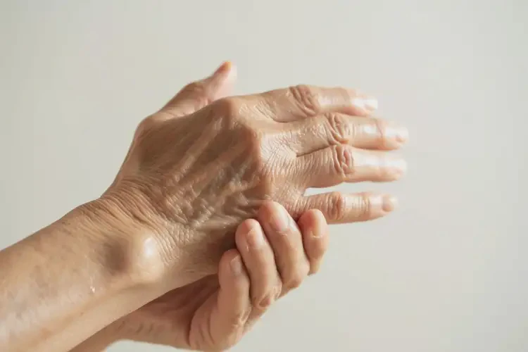 高齡老人手臂容易長濕疹不管它會自己好嗎(圖4)