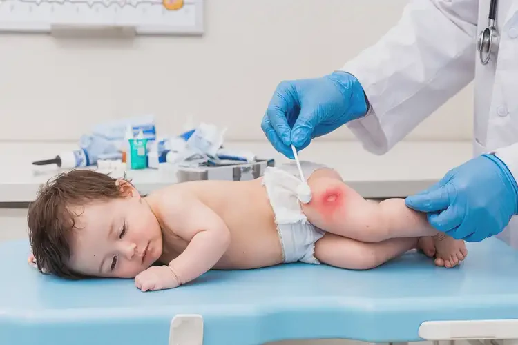 幼儿屁股上起湿疹能靠自己自愈吗(图3)