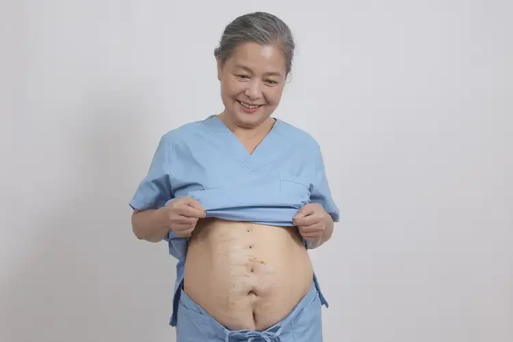 產婦肚子上偶爾長濕疹能夠徹底治愈嗎(圖4)