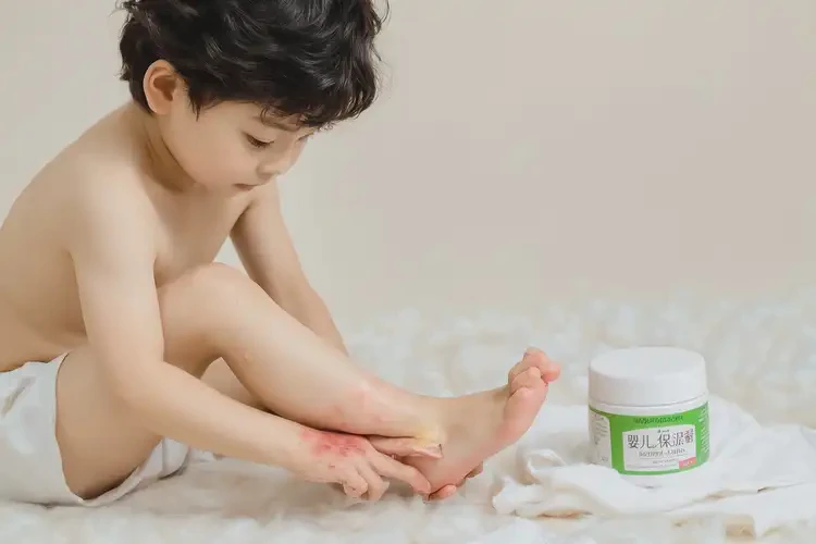 小兒腳上出現(xiàn)濕疹不管它會(huì)自己好嗎(圖2)