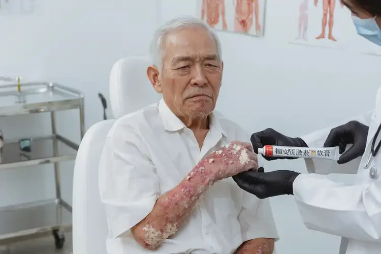 老年人全身出濕疹能不能徹底自愈(圖3)