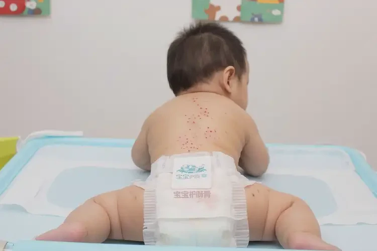 少兒肛周出現濕疹能徹底自愈嗎(圖4)