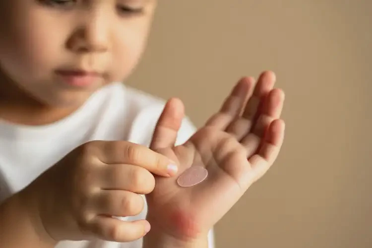 孩子四肢容易起濕疹不管它會(huì)自己自愈嗎(圖2)