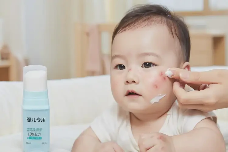 婴幼儿身上长湿疹不管它会自己好吗(图4)