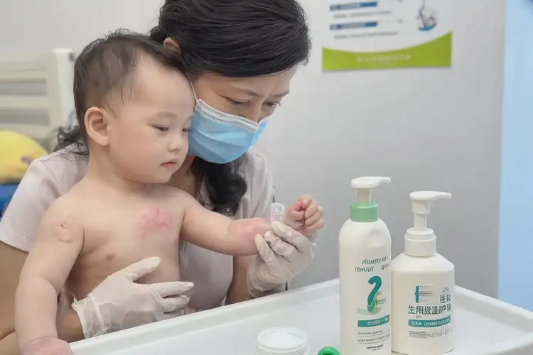 孩子臉上有濕疹不管它會自己自愈嗎(圖3)