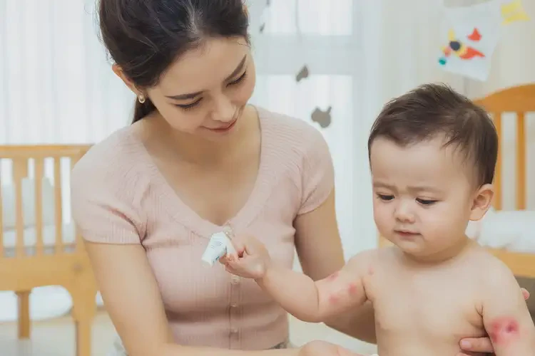 新生儿手臂上出现湿疹不管它会自己自愈吗(图3)