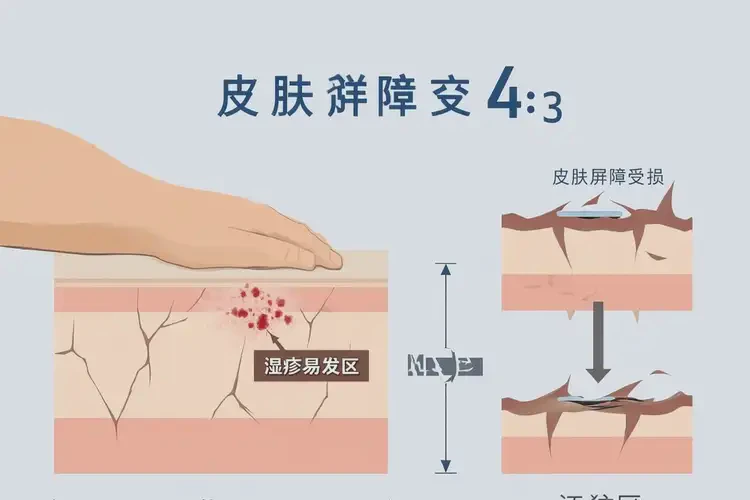 老年人四肢出現(xiàn)濕疹可不可以徹底自愈(圖4)