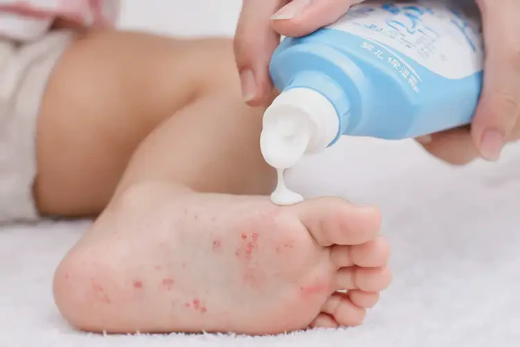 小兒腳上容易長濕疹不管它會自己自愈嗎(圖3)