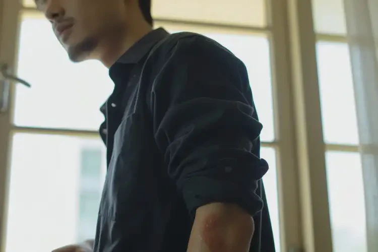 男人身上經(jīng)常起濕疹可以徹底自愈嗎(圖2)