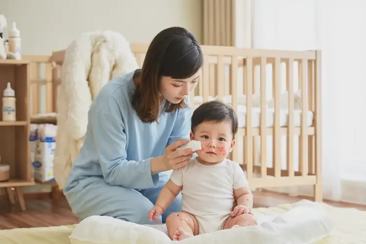 嬰幼兒全身偶爾起濕疹能夠徹底治愈嗎(圖3)