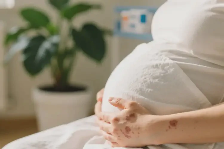 產(chǎn)婦四肢偶爾起濕疹不管它會(huì)自己痊愈嗎(圖4)