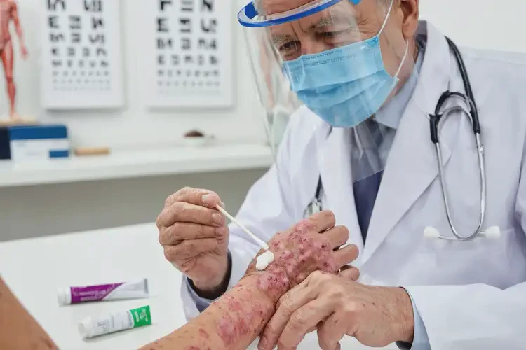 老人手上經(jīng)常長濕疹不管它會自己好嗎(圖3)