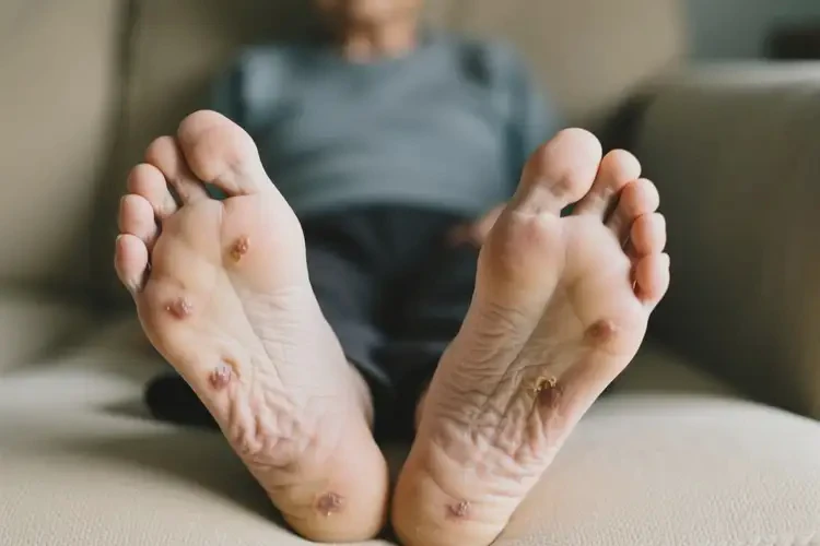 老年人腳上偶爾起濕疹不管它會(huì)自己痊愈嗎(圖2)